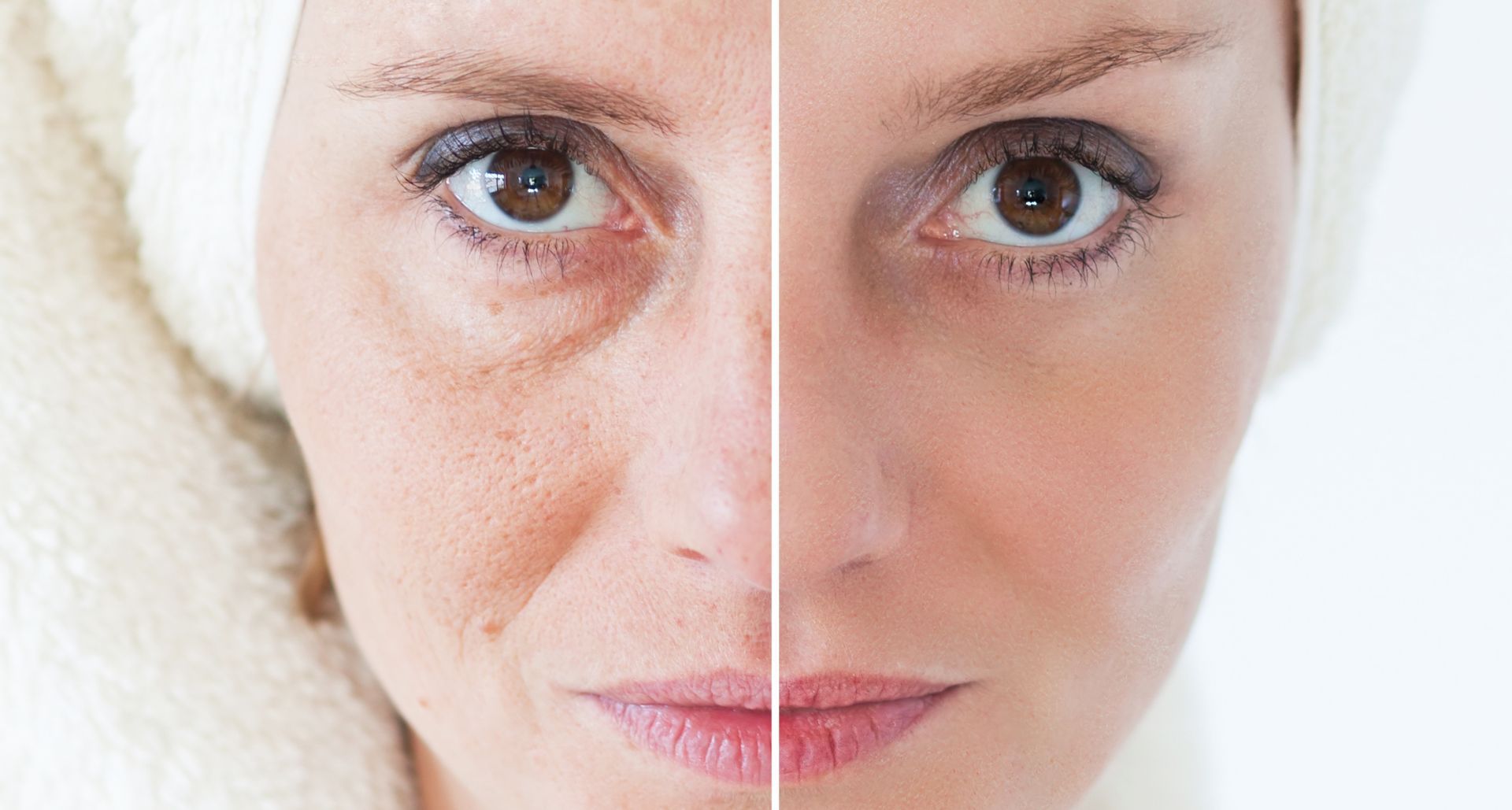 جوانسازی بدون جراحی: روش‌های مدرن زیبایی